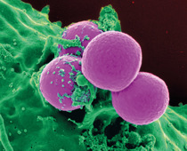 Blutzelle unter dem Mikroskop, Foto: CC0